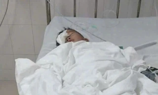 Học sinh nguy cơ hỏng mắt do bạn chọc trúng.