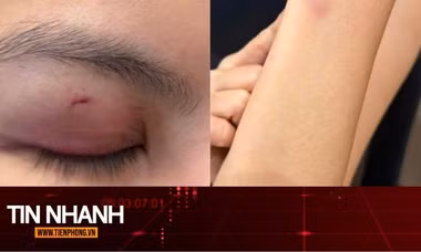 TIN NHANH: Luật sư nhận định vụ ca sĩ Trung Quân Idol bị tố đánh phụ nữ