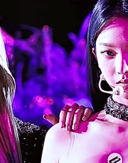 Làn da bị mụn trên trán của Karina bị lộ trước ống kính