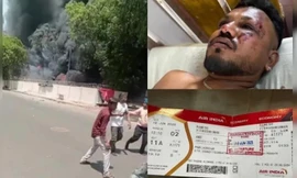 Người sống sót duy nhất vụ rơi máy bay Air India: 'Mỗi ngày đều là nỗi đau'