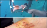 'Hot clip' một du khách Trung Quốc bị cá mập cắn khi đang lặn ở Maldives được lan truyền rộng rãi