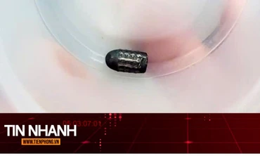 TIN NHANH: Hy hữu người phụ nữ sống sót dù bị đạn lạc găm trúng đầu