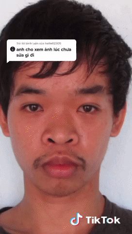 Khoe quá trình “lột xác”, chàng trai gây sốc khi lấy ảnh tội phạm làm ảnh chưa phẫu thuật ảnh 3