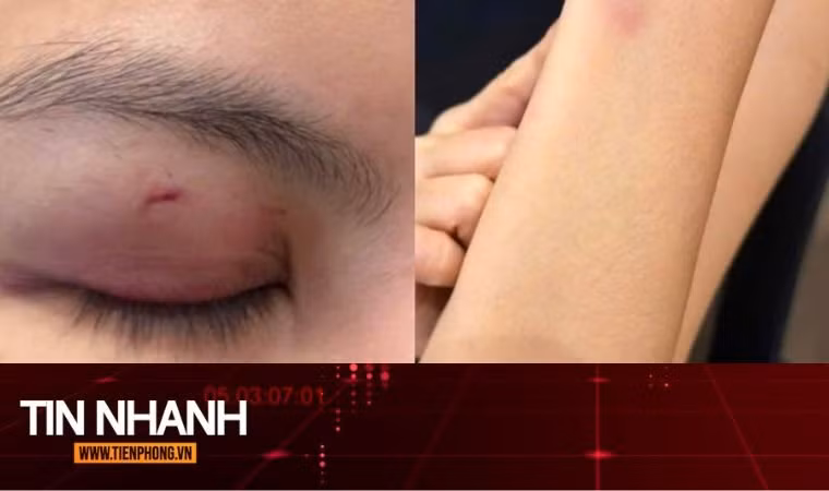 TIN NHANH: Luật sư nhận định vụ ca sĩ Trung Quân Idol bị tố đánh phụ nữ