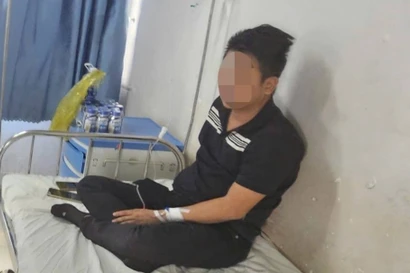 Ăn vách bò um cà đắng, 3 người sưng phù mặt, khó thở phải cấp cứu