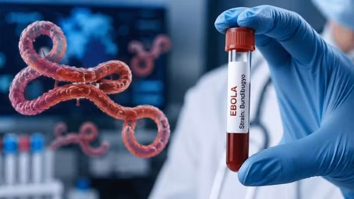 Bộ Y tế kích hoạt giám sát dịch Ebola, tăng cường ngăn dịch xâm nhập 