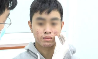 'Hàng hiệu' giá bèo từ chợ đến mạng - bài 2: Phía sau lời quảng cáo 'trắng cấp tốc'