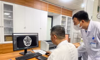 Các bác sĩ quan sát tổn thương trên não bệnh nhân do sử dụng bóng cười 
