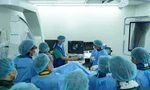 Lần đầu tại Việt Nam, phẫu thuật khoan cắt mảng xơ vữa mạch máu bằng laser