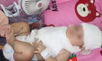 Bé trai 'khổng lồ' bị liệt cánh tay do sang chấn sản khoa khi chào đời