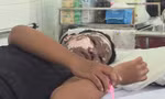 Chơi pháo nổ, bé trai bị tai nạn cháy đen khuôn mặt