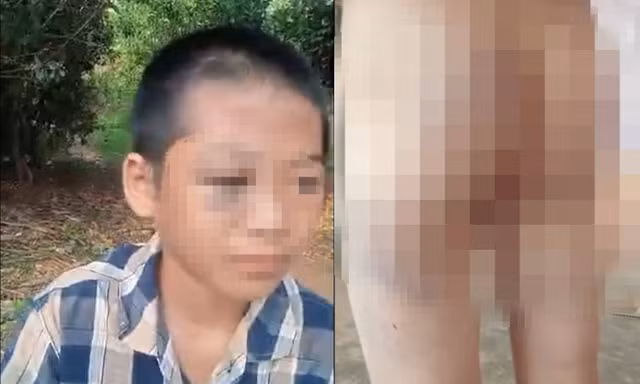 Xôn xao clip học sinh lớp 6 nghi bị người thân bạo hành