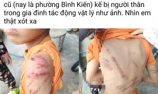 Công an vào cuộc vụ bé trai 10 tuổi ở Đắk Lắk chi chít vết thương