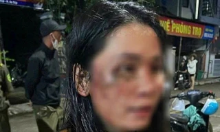 Nữ nhân viên giao hàng tố bị gia đình khách hành hung, nhập viện cấp cứu