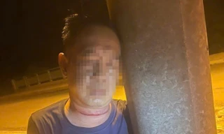 Phát hiện người đàn ông nguy kịch bên trụ điện, trên cổ có vết thương