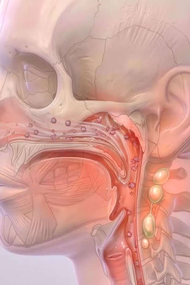 Bệnh não mô cầu nguy hiểm như thế nào và cách nhận biết sớm