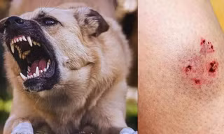 Chó 'điên' cắn 4 người ở Quảng Ngãi dương tính vi rút dại