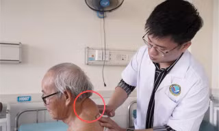 Đà Nẵng: Cụ ông mang khối u vùng cổ gáy suốt 40 năm