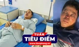 TIÊU ĐIỂM: Tuyên án bác sỹ hiếp dâm nữ bệnh nhân; Sức khoẻ 2 anh em bị đánh khi giúp người gặp nạn 