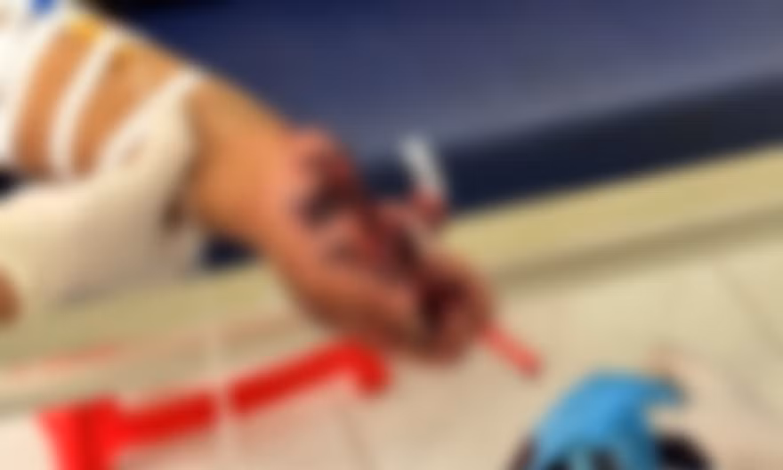 Điện thoại đang sạc phát nổ, thiếu niên bị thương nặng