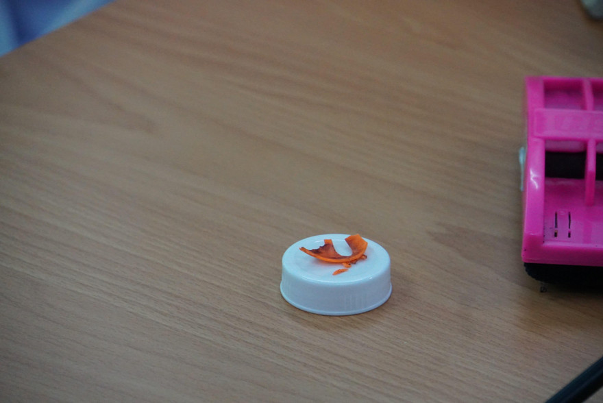 Miếng nhựa ‘âm thầm’ trú ngụ trong cơ thể bé trai 11 tháng suốt 5 tháng trời