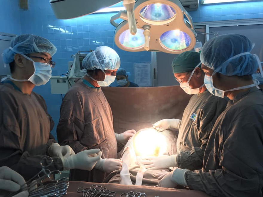 Choáng với khối u khủng nặng 25 kg trong ổ bụng bệnh nhân