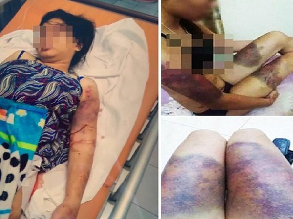 Bố cô gái bị giam giữ, tra tấn suốt 21 ngày: 'Tôi đau như chết đi sống lại'