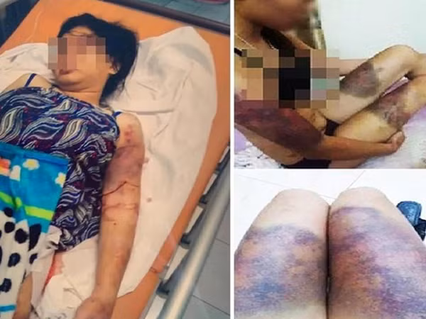 Bố cô gái bị giam giữ, tra tấn suốt 21 ngày: 'Tôi đau như chết đi sống lại'
