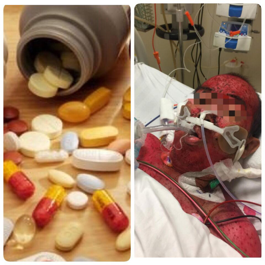 Người đàn ông ngoại quốc hôn mê sâu sau khi tự mua thuốc cảm uống