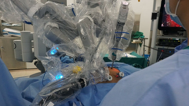 Lần đầu tiên dùng robot mổ lấy thận tại Việt Nam