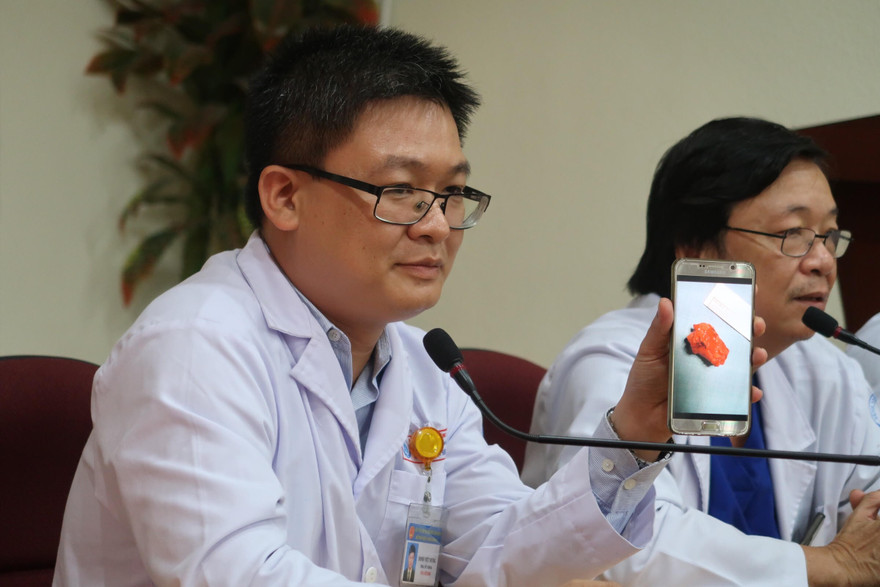 Ho kéo dài không khỏi, bé gái suýt chết vì khối bướu hiếm gặp