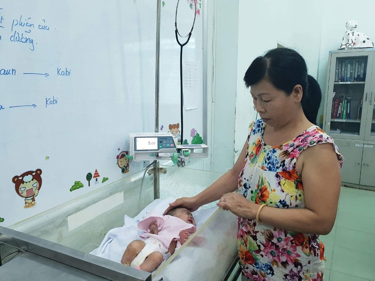 Cứu thành công bàn tay bé sơ sinh bị hoại tử lồi xương 