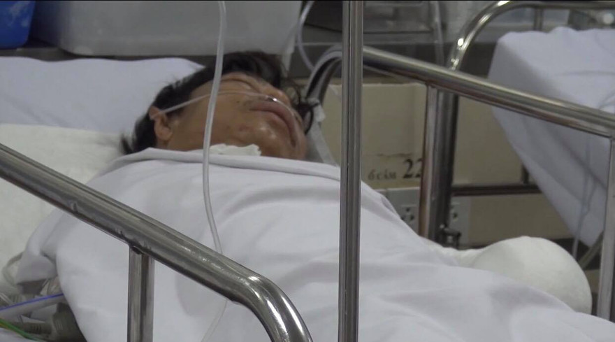 Nạn nhân kể lại giây phút kinh hoàng bị hổ cắn cụt hai tay