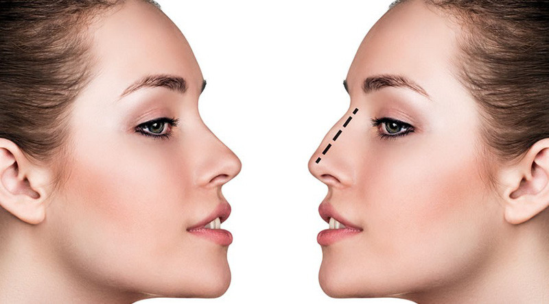 Ảnh minh hoạ: Internet