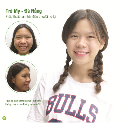 10 tỉ đồng phẫu thuật thẩm mỹ miễn phí cho người có hoàn cảnh khó khăn