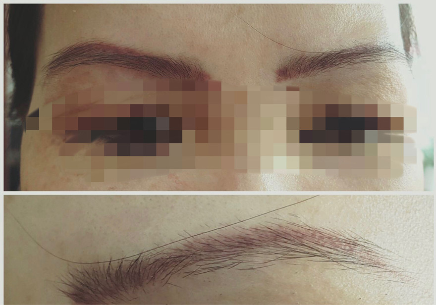 Người phụ nữ nguy kịch sau xăm lông mày đã tử vong