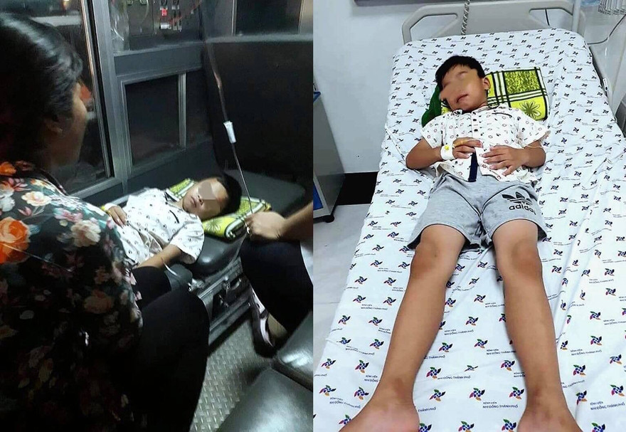 Bác sĩ thắt thòng lọng nội soi gắp que kẹo mút ra khỏi họng em bé