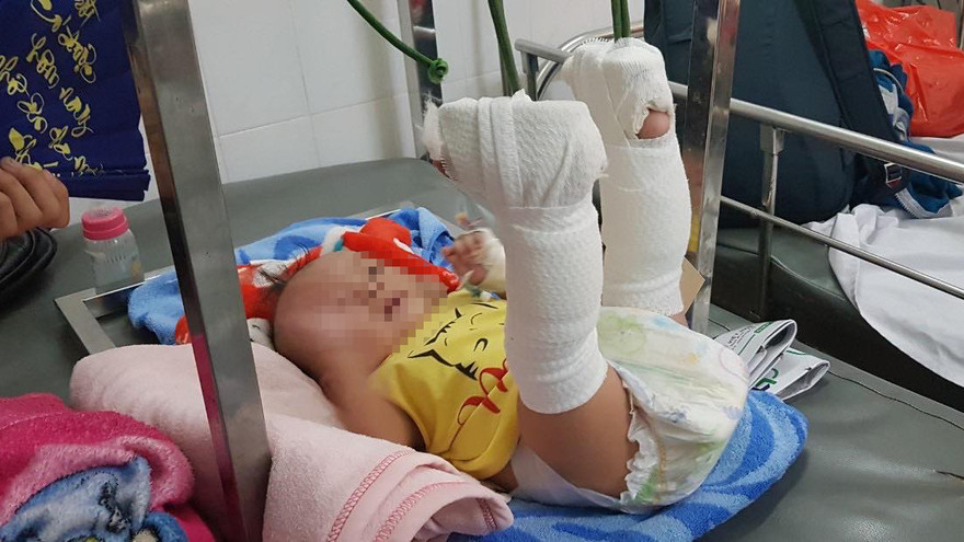 Bé trai 4 tháng tuổi nghi bị cha đánh xuất huyết não