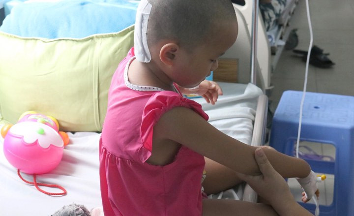 Bé gái suýt chết vì chấn thương sọ não do cha mẹ chủ quan