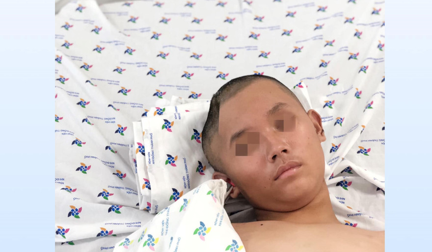 Ngỡ sốt đau đầu thông thường, bé trai hôn mê do phù não