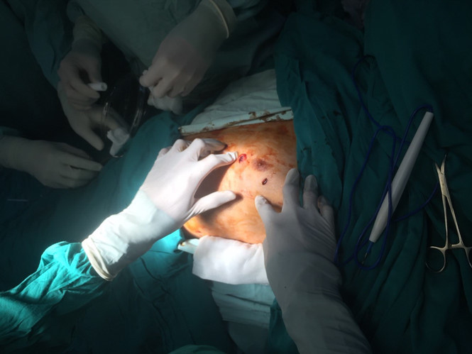 Chờ mổ chân, nam bệnh nhân tự dùng kéo... đâm thủng tim