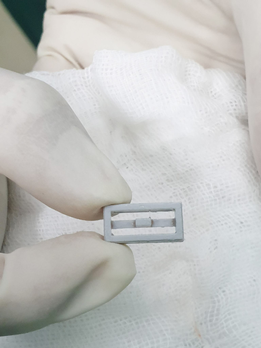 Bé trai 8 tuổi suýt chết vì nuốt phải món đồ chơi trẻ nào cũng thích