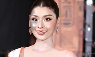 Người đẹp bị chàm nửa gương mặt giành giải á hậu