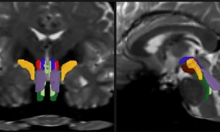 Thuật toán AI có thể 'mở cửa sổ' để quan sát những sợi trắng trong thân não