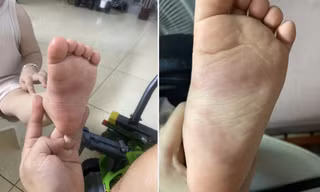 Xác minh thông tin bé trai 3 tuổi nghi bị giáo viên bạo hành ở Hưng Yên