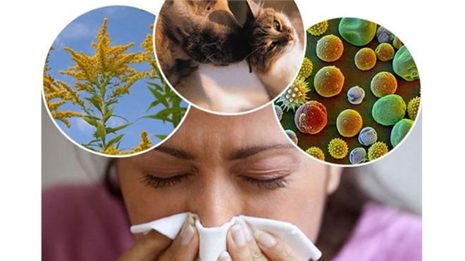 5 mẹo tự chữa dị ứng hiệu quả tại nhà