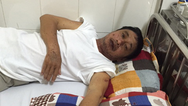 Bệnh nhân Trương Như La đang điều trị tại BV