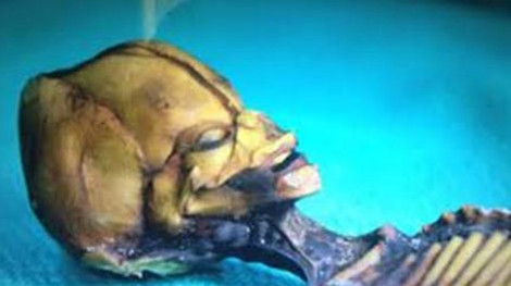 Hộp sọ quá khổ của “Ata”.