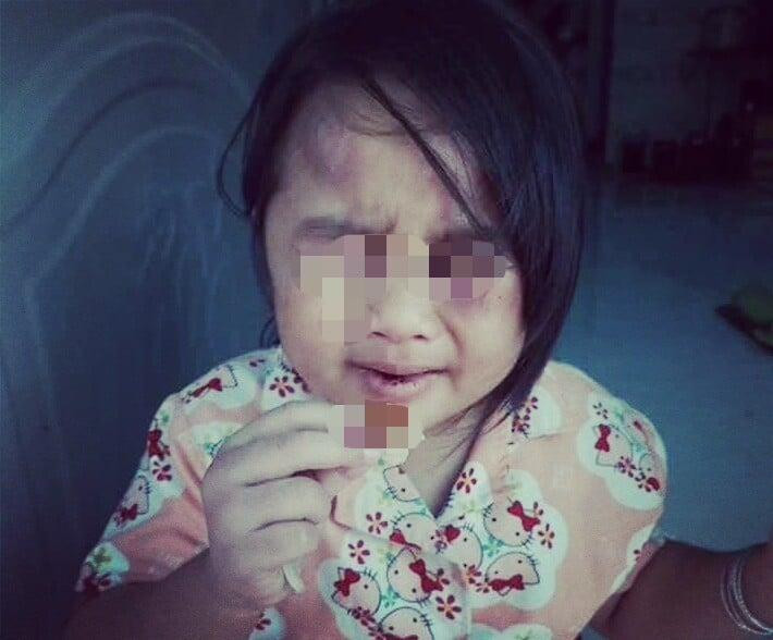 Cha về quê, con bị cô và dượng đánh đập tàn bạo