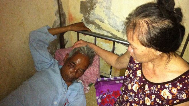 Ông Lê Ngọc Thanh đang điều trị tại Bệnh viện Đa khoa Hà Tĩnh. 